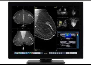 Barco Launches Flagship Breast Radiology Display as Breast Cancer Awareness Month Begins